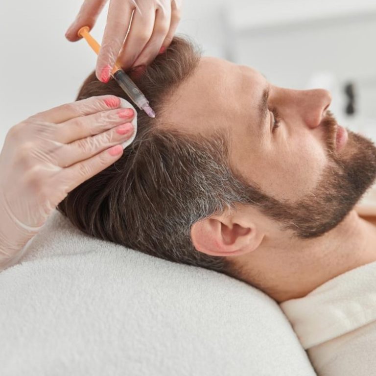 Hair Mesotherapy in Turkey